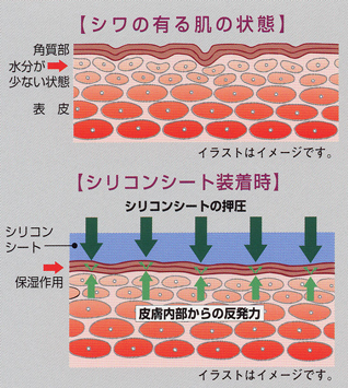 シワのある肌の状態と、シリコンシート装着時